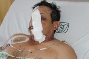 Cirugía, IMSS, Accidente de Trabajo